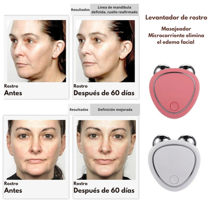 Masajeador de Microcorriente Facial